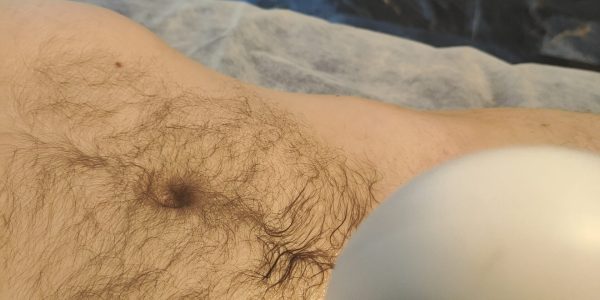 oplus_34